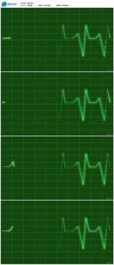 吃瓜心电图视频,揭秘瓜界“心跳”的秘密